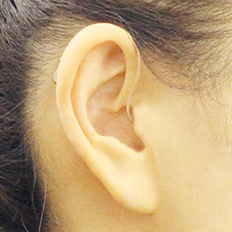 耳かけ型補聴器の装着状態